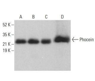 Phocein Antibody (16E2) - Western Blotting - Image 377998 