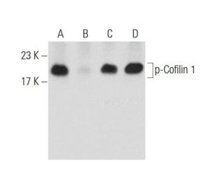 Phosphatase Inhibitor Cocktail B: sc-45045. Western blot analysis of Cofilin 1 phosphorylation in K-562 (A), lambda phosph 