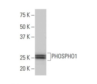 PHOSPHO1 Antibody (II-91) - Western Blotting - Image 33728