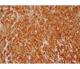 phostensin Antibody (C-1) - Immunohistochemistry - Image 286381 