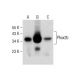 This polyclonal antibody has been discontinued. See our recommended <a href="phox2b-antibody-b-11">Phox2b (B-11)</a> monoclonal antibody (sample data shown). western blotting image from recommended Phox2b (B-11) monoclonal antibody replacement. Image 283861
