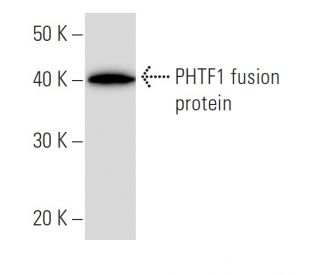 PHTF1 Antibody (PHTF1R8) - Western Blotting - Image 16874 
