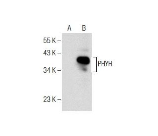 PHYH Antibody (E-8) - Western Blotting - Image 158435
