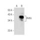 PHYH Antibody (E-8) - Western Blotting - Image 158435