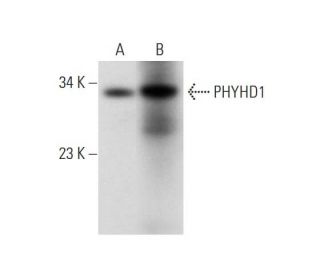 PHYHD1 Antibody (B-6) - Western Blotting - Image 304322