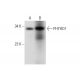 PHYHD1 Antibody (B-6) - Western Blotting - Image 304322