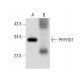 PHYHD1 Antibody (G-12) - Western Blotting - Image 306616