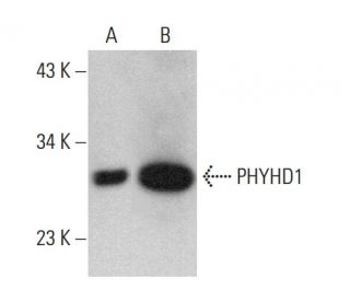 PHYHD1 Antibody (G-12) - Western Blotting - Image 375467 