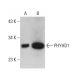 PHYHD1 Antibody (G-12) - Western Blotting - Image 375467 
