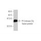 PI 3-kinase C2γ Antibody (3D8) - Western Blotting - Image 348567