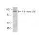 PI 3-kinase p101 Antibody (E-12) - Western Blotting - Image 379086 