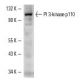 western blotting image from recommended PI 3-kinase p110 (D-4) monoclonal antibody replacement. Image 2279