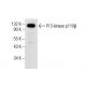 PI 3-kinase p110β Antibody (B-5) - Western Blotting - Image 155525