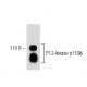 PI 3-kinase p110δ Antibody (29) - Western Blotting - Image 60405