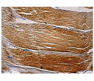 PI 4-kinase &beta; Antibody (A-2) - Immunohistochemistry - Image 159639 