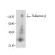 PI 4-kinase β Antibody (A-2) - Western Blotting - Image 109098