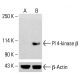 PI 4-kinase β Antibody (A-2) - Western Blotting - Image 413806 