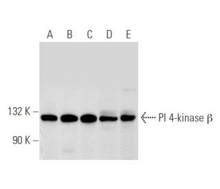 PI 4-kinase &beta; Antibody (E-4) - Western Blotting - Image 65625 