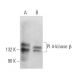 PI 4-kinase β Antibody (E-4) - Western Blotting - Image 365949