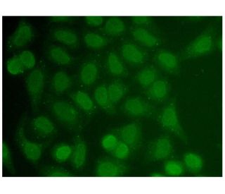 immunofluorescence image from recommended PIAS 1 (F-1) monoclonal antibody replacement. Image 306446
