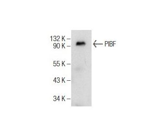 PIBF Antibody (C-9) - Western Blotting - Image 160589