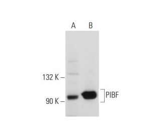 PIBF Antibody (F-12) - Western Blotting - Image 127785 