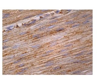 PICK1 Antibody (B-6) - Immunohistochemistry - Image 161064 