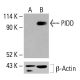 PIDD Antibody (B-5): sc-514981. Western blot analysis of PIDD expression in untreated (A) and chemically-treated (B) HeLa whole cell lysates. β-Actin (C4): sc-47778 used as loading control. Detection reagent used: m-IgG Fc BP-HRP: sc-525409. PIDD Antibody (B-5) - Western Blotting - Image 415843