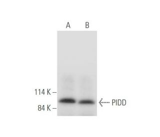 western blotting image from recommended PIDD (B-5) monoclonal antibody replacement. Image 333663