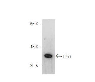 PIG3 Antibody (10A2) - Western Blotting - Image 67420