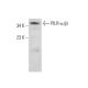 PILR-α/β Antibody (H-2) - Western Blotting - Image 384746