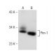 western blotting image from recommended Pim-1 (G-11) monoclonal antibody replacement. Image 148789