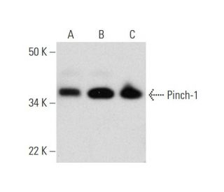 Pinch-1 Antibody (A-1) - Western Blotting - Image 292112 