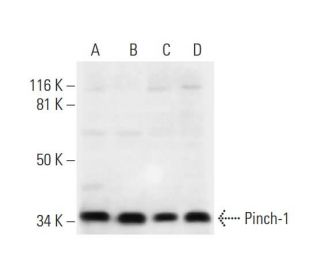 Pinch-1 Antibody (B-8) - Western Blotting - Image 292910 