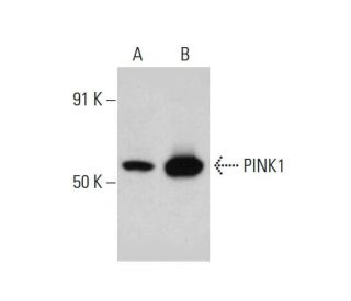 western blotting image from recommended PINK1 (38CT20.8.5) monoclonal antibody replacement. Image 384286