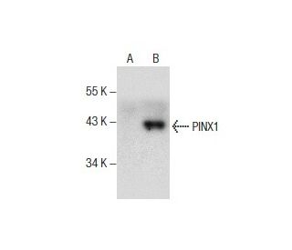PINX1 Antibody (A-9) - Western Blotting - Image 157478 