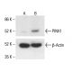 PINX1 Antibody (A-9) - Western Blotting - Image 411301