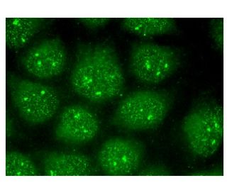 PINX1 Antibody (D-3) - Immunofluorescence - Image 151310 