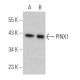 PINX1 Antibody (D-3) - Western Blotting - Image 367371