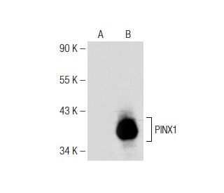 PINX1 Antibody (E-9) - Western Blotting - Image 148787 