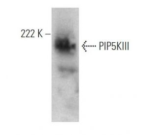 PIP5KIII Antibody (64-Q6) - Western Blotting - Image 368258 