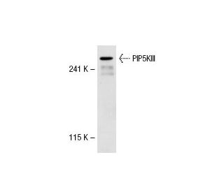 PIP5KIII Antibody (64-Q6) - Western Blotting - Image 31680Each CRISPR/Cas9 Knockout (KO) Plasmid product consists of a pool of 3 plasmids designed to ensure identification and cleavage of a specific gene for maximum knockout efficiency. Each plasmid encodes a unique 20 nt sequence derived from the GeCKO (v2) library.