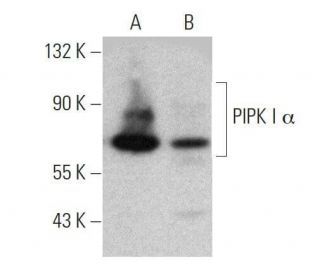PIPK I &alpha; Antibody (B-10) - Western Blotting - Image 358695 