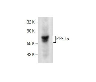 western blotting image from recommended PIPK I &alpha; (D-12) monoclonal antibody replacement. Image 260766