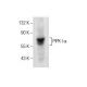 western blotting image from recommended PIPK I α (D-12) monoclonal antibody replacement. Image 260766