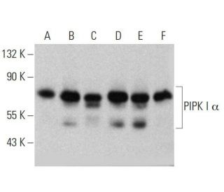 PIPK I &alpha; Antibody (D-4) - Western Blotting - Image 358673 