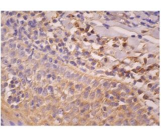 PIPK I &alpha; Antibody (E-3) - Immunohistochemistry - Image 263024 