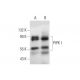 PIPK I Antibody (D-12) - Western Blotting - Image 138527 
