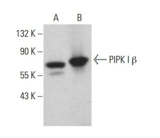 PIPK I &beta; Antibody (F-4) - Western Blotting - Image 375418 