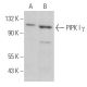 PIPK I γ Antibody (D-7) - Western Blotting - Image 362233